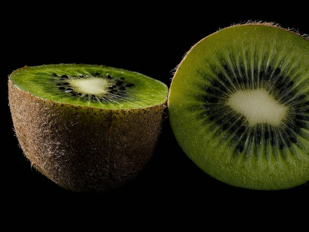 Kiwi Fruit Bundles